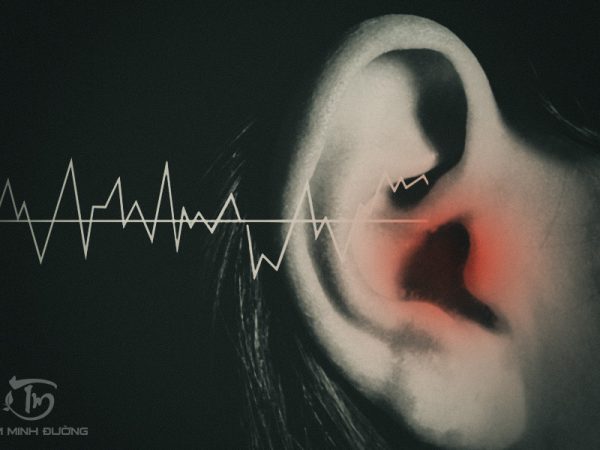 Bị ù tai là bệnh gì